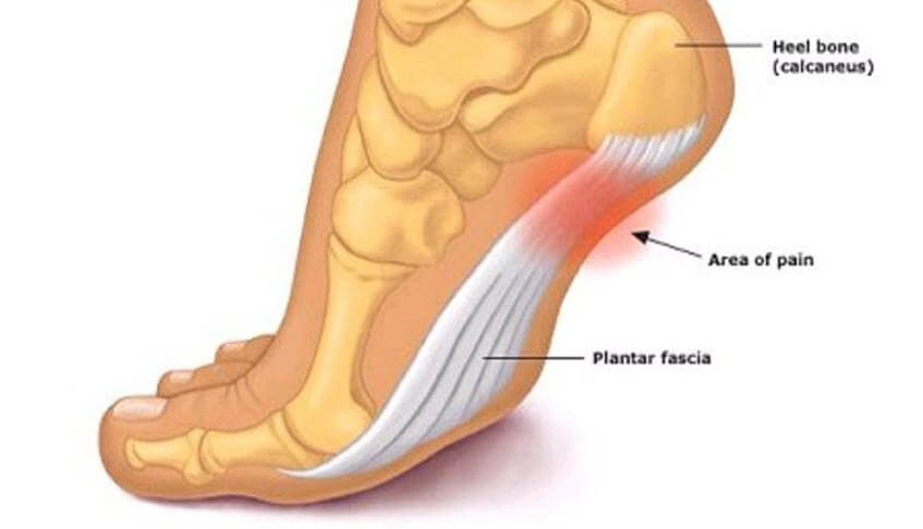 Inside upper heel pain. What could it be? This area is tender in  touching/pressing this area and is very sore especially when walking. I  have been running in Shamma sandals well over