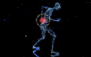 Sciatica Pain